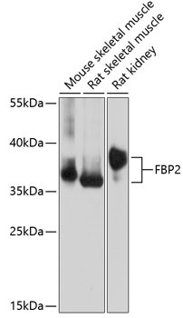 FBP2 Antibody in Western Blot (WB)