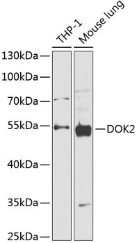 DOK2 Antibody in Western Blot (WB)
