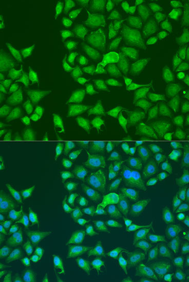 STAU2 Antibody in Immunocytochemistry (ICC/IF)