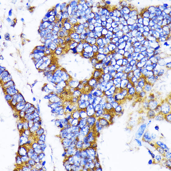 MRPL13 Antibody in Immunohistochemistry (Paraffin) (IHC (P))