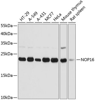 NOP16 Antibody in Western Blot (WB)