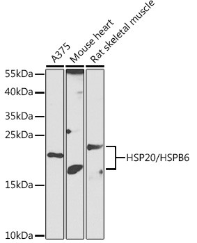 HSP20 Antibody in Western Blot (WB)