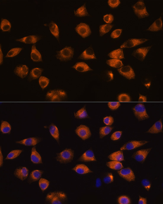 EphA5 Antibody in Immunocytochemistry (ICC/IF)