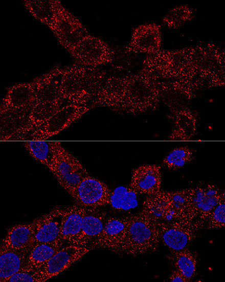 RPL21 Antibody in Immunocytochemistry (ICC/IF)