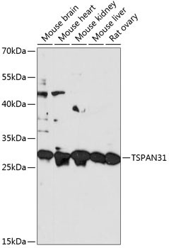 TSPAN31 Antibody in Western Blot (WB)