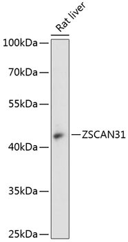 ZNF323 Antibody in Western Blot (WB)