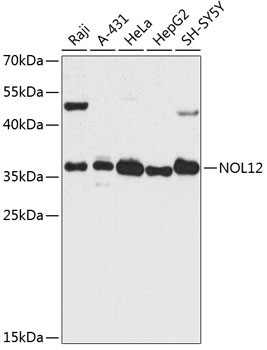 Nop25 Antibody in Western Blot (WB)