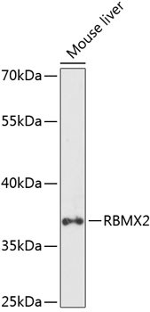 RBMX2 Antibody in Western Blot (WB)