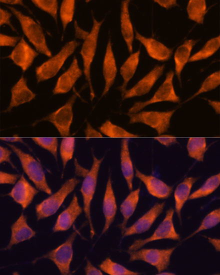 LHPP Antibody in Immunocytochemistry (ICC/IF)