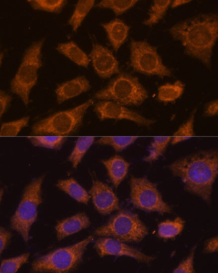 PREPL Antibody in Immunocytochemistry (ICC/IF)