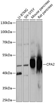 Carboxypeptidase A2 Antibody in Western Blot (WB)