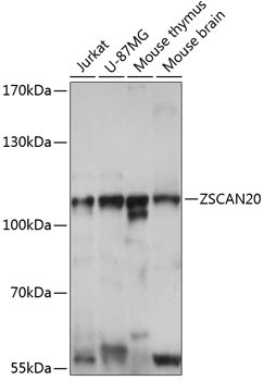 ZNF31 Antibody in Western Blot (WB)
