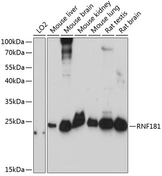 RNF181 Antibody in Western Blot (WB)
