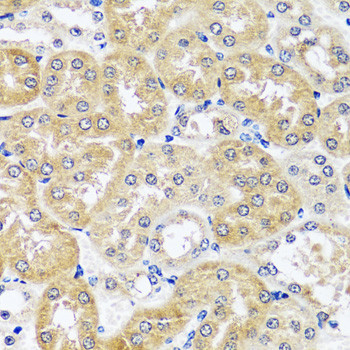CCDC124 Antibody in Immunohistochemistry (Paraffin) (IHC (P))