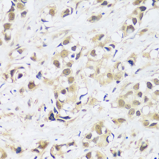 ASCL4 Antibody in Immunohistochemistry (Paraffin) (IHC (P))
