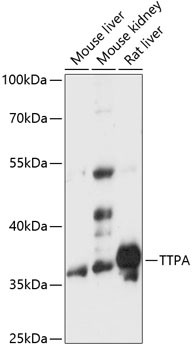 alpha TTP Antibody in Western Blot (WB)