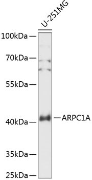 ARPC1A Antibody in Western Blot (WB)