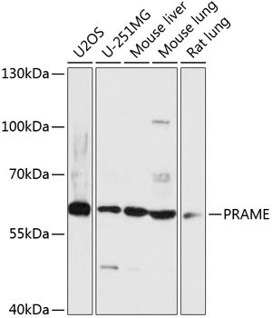 PRAME Antibody in Western Blot (WB)