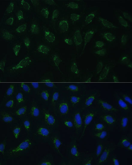 HIGD1A Antibody in Immunocytochemistry (ICC/IF)