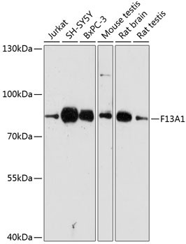 Factor XIII A Antibody in Western Blot (WB)