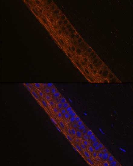 MYH13 Antibody in Immunohistochemistry (Paraffin) (IHC (P))