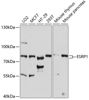 ESRP1 Antibody in Western Blot (WB)