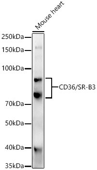 CD36 Antibody in Western Blot (WB)
