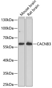 CACNB3 Antibody in Western Blot (WB)