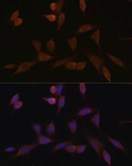 NDUFA5 Antibody in Immunocytochemistry (ICC/IF)