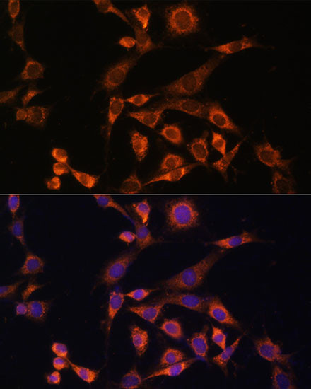 MEK2 Antibody in Immunocytochemistry (ICC/IF)