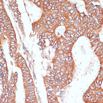 PTPRN2 Antibody in Immunohistochemistry (Paraffin) (IHC (P))