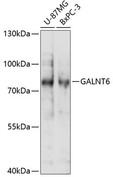 GALNT6 Antibody in Western Blot (WB)