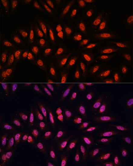 KLHL8 Antibody in Immunocytochemistry (ICC/IF)