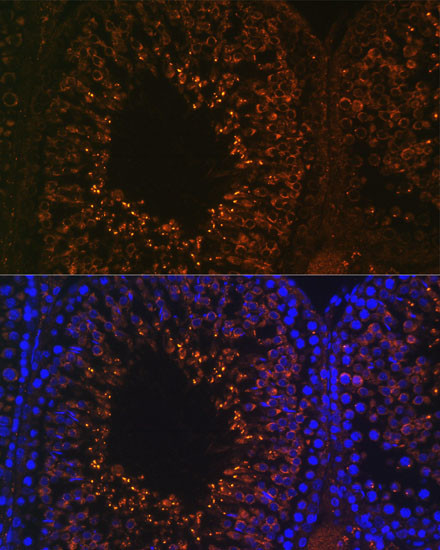 LDHAL6B Antibody in Immunohistochemistry (Paraffin) (IHC (P))