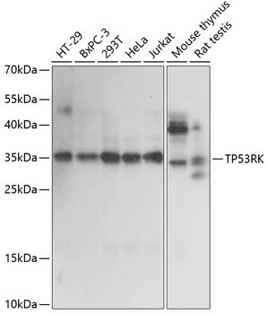 PRPK Antibody in Western Blot (WB)