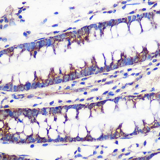 MRPL54 Antibody in Immunohistochemistry (Paraffin) (IHC (P))
