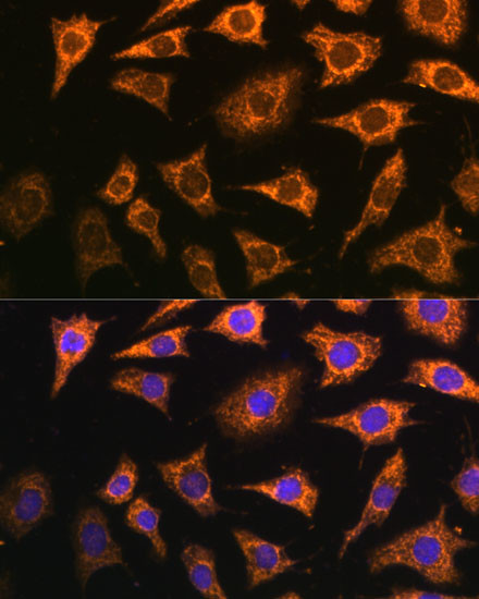 PDHA2 Antibody in Immunocytochemistry (ICC/IF)