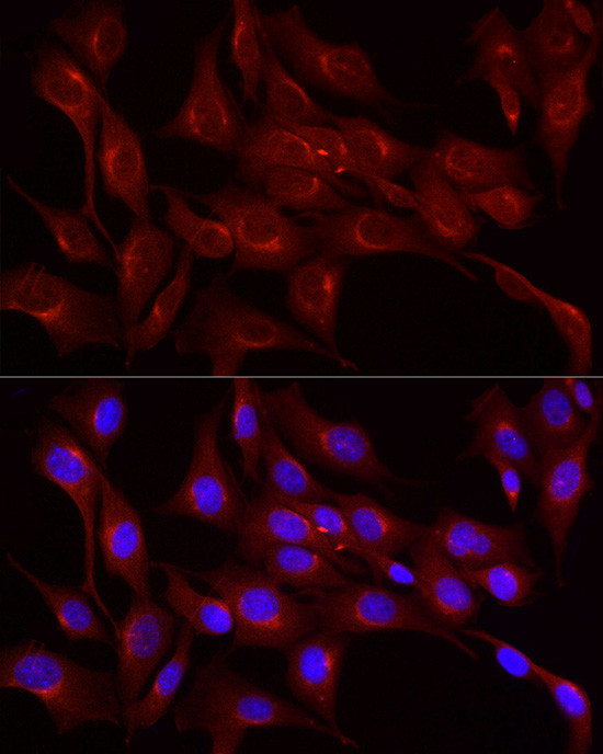 LDLR Antibody in Immunocytochemistry (ICC/IF)