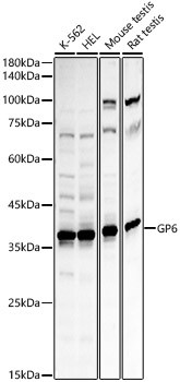 GP6 Antibody in Western Blot (WB)