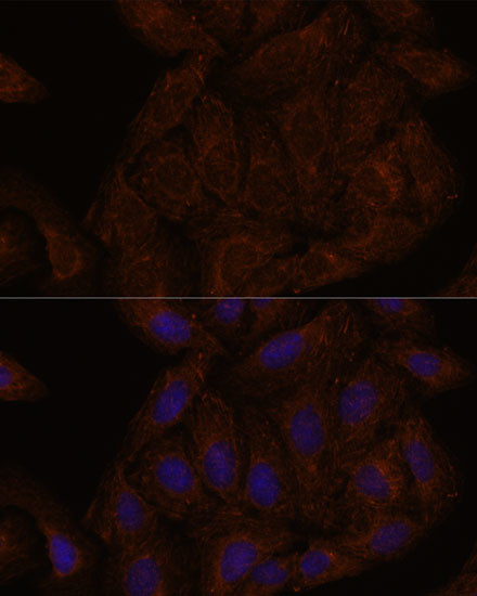 Septin-8 Antibody in Immunocytochemistry (ICC/IF)