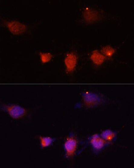 NPY Antibody in Immunocytochemistry (ICC/IF)