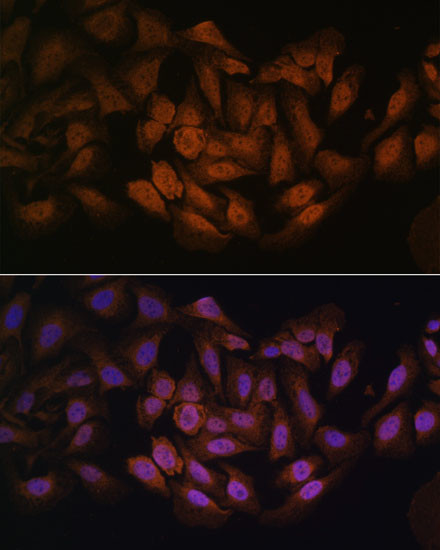 ZNF9 Antibody in Immunocytochemistry (ICC/IF)