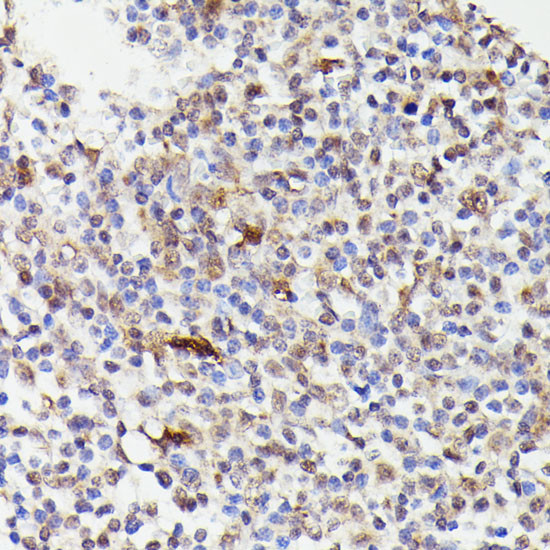 Cdc23 Antibody in Immunohistochemistry (Paraffin) (IHC (P))