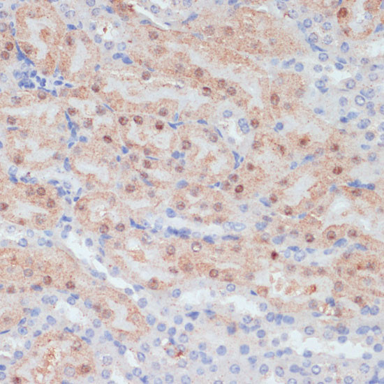 Claudin 17 Antibody in Immunohistochemistry (Paraffin) (IHC (P))