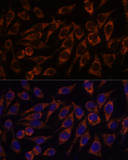 PYCR2 Antibody in Immunocytochemistry (ICC/IF)