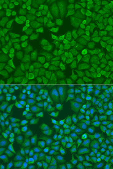 IGF2BP1 Antibody in Immunocytochemistry (ICC/IF)