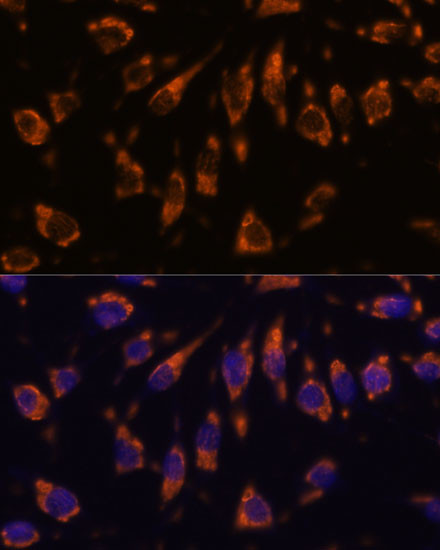 CRELD1 Antibody in Immunocytochemistry (ICC/IF)
