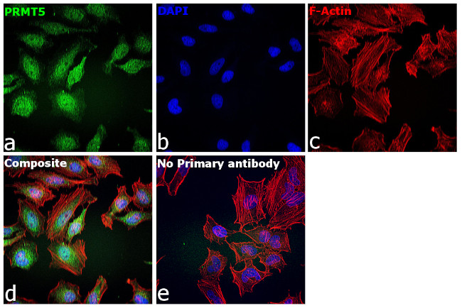 PRMT5 Antibody in Immunocytochemistry (ICC/IF)
