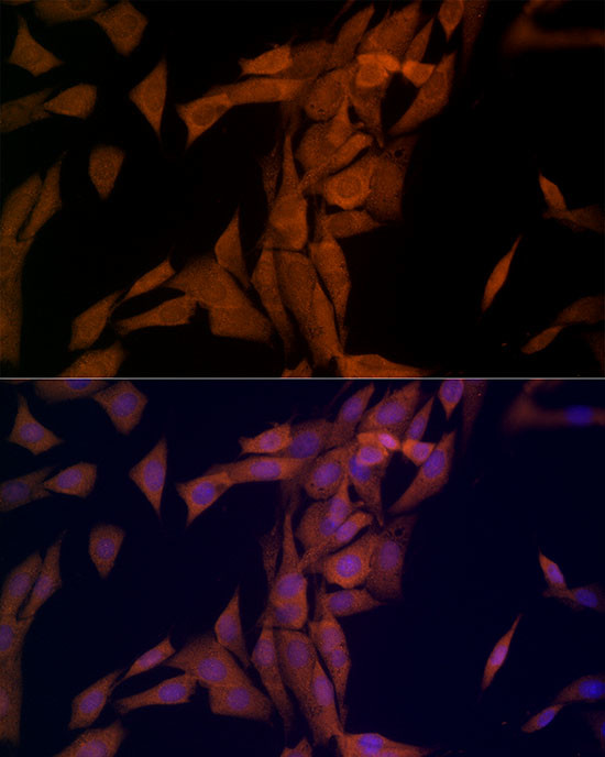 OTUD4 Antibody in Immunocytochemistry (ICC/IF)