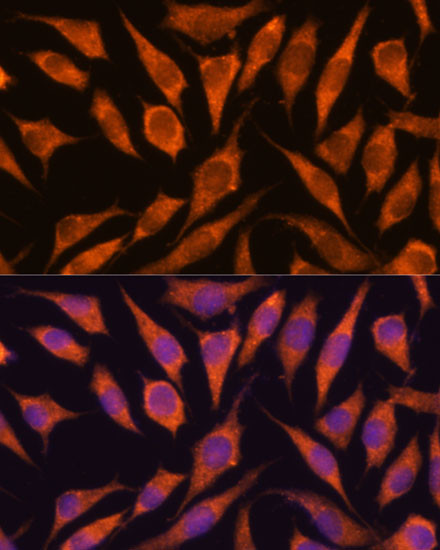 RPAP3 Antibody in Immunocytochemistry (ICC/IF)